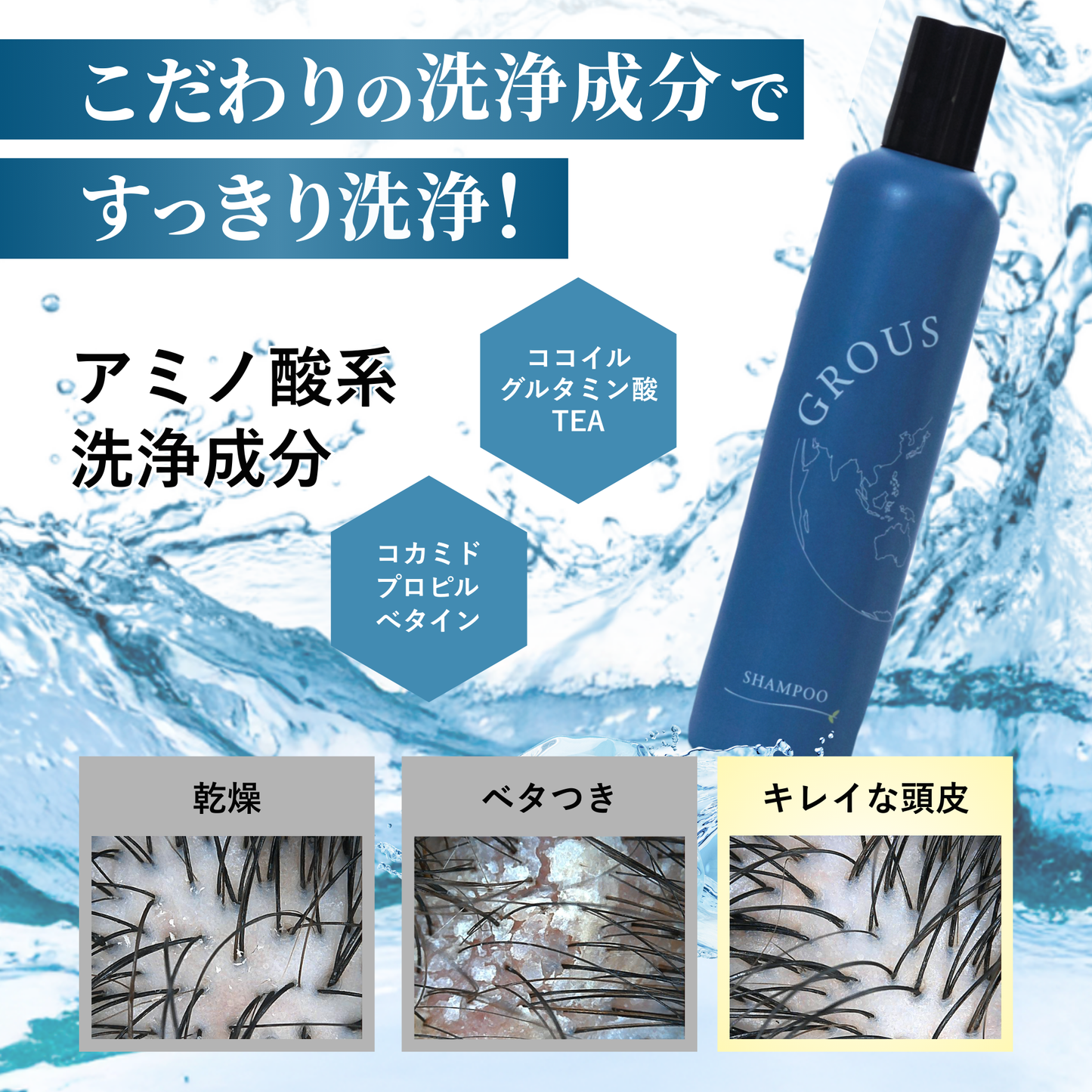 育毛シャンプー